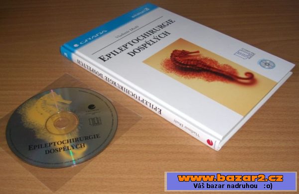 Epileptochirurgie dospělých